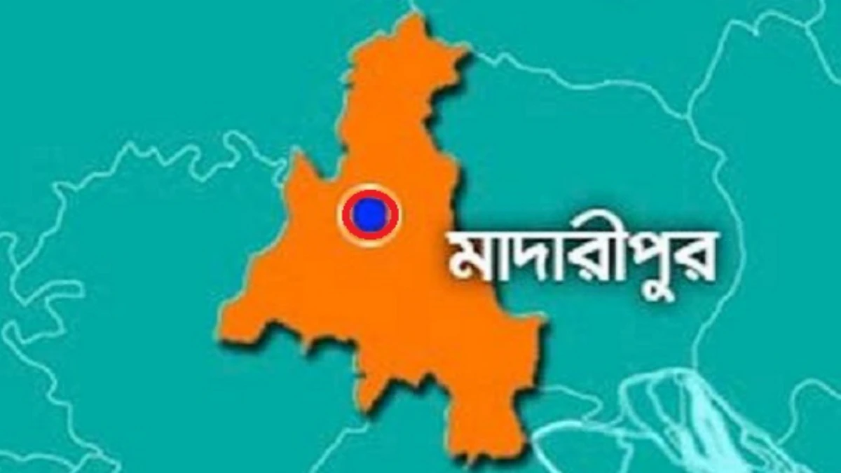 ইতালি প্রবাসীর গোপনাঙ্গ কাটার অভিযোগে স্ত্রী আটক