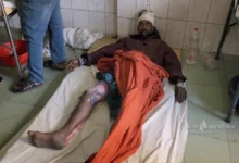 মাছ চুরির অপবাদ দিয়ে দিনমজুরের পা ভেঙে দিলেন বিএনপি নেতা