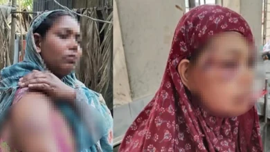 দাঁড়িপাল্লায় ভোট দেওয়ায় তিন নারীকে পিটিয়ে আহত, মামলা দায়ের