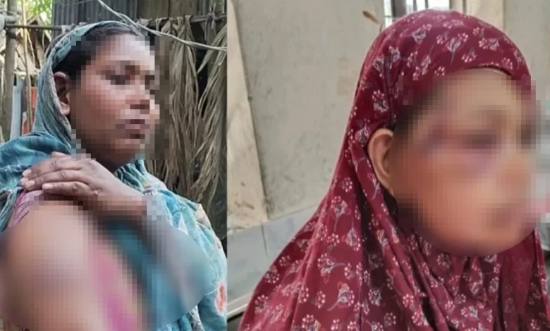 দাঁড়িপাল্লায় ভোট দেওয়ায় তিন নারীকে পিটিয়ে আহত, মামলা দায়ের