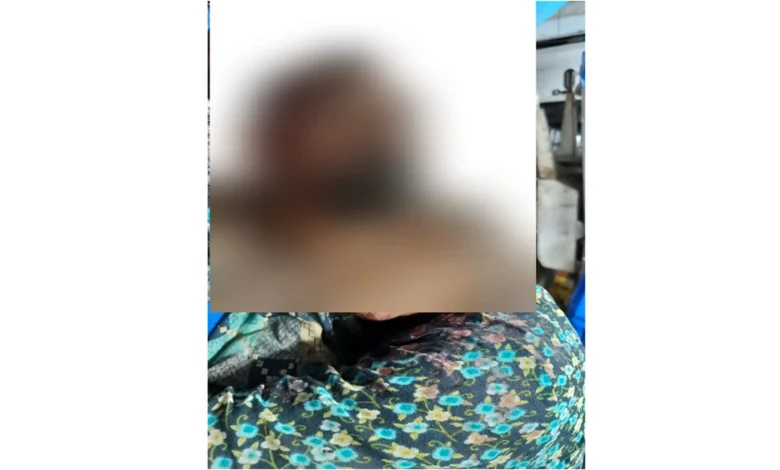 যশোরে বাড়িতে ঢোকা নিয়ে বিরোধ মাদকাসক্ত যুবকের লাঠির আঘাতে মামি-শাশুড়ি গুরুতর আহত