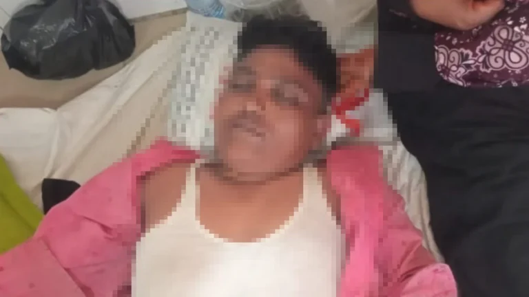 কমলনগরে মাংস ওজনে কম দেওয়ার প্রতিবাদ করায় ক্রেতার ওপর কসাইয়ের হামলা