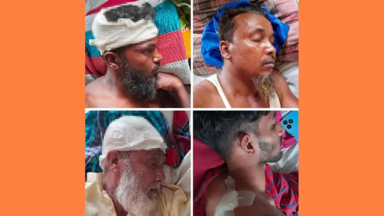 মোকামতলায় তুচ্ছ ঘটনাকে কেন্দ্র করে সংঘর্ষ, অবসরপ্রাপ্ত ব্যাংক কর্মকর্তাসহ আহত ৪