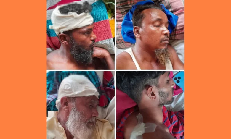 মোকামতলায় তুচ্ছ ঘটনাকে কেন্দ্র করে সংঘর্ষ, অবসরপ্রাপ্ত ব্যাংক কর্মকর্তাসহ আহত ৪
