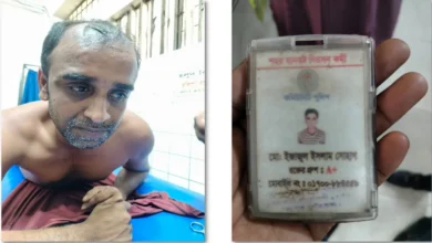 যশোরে তুচ্ছ ঘটনায় কমিউনিটি পুলিশ সদস্যকে কুপিয়ে জখম