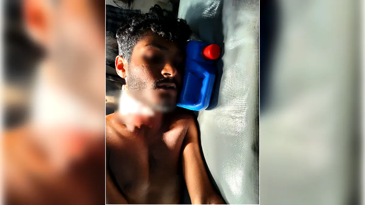 যশোরে পারিবারিক কলহ বড় ভাইয়ের বটির কোপে ছোট ভাই জখম