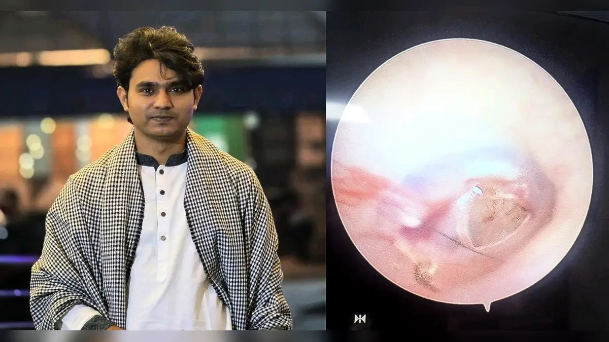 শাহবাগে ছাত্রদলের হামলায় জুলহাসের কানের পর্দা ফাটল