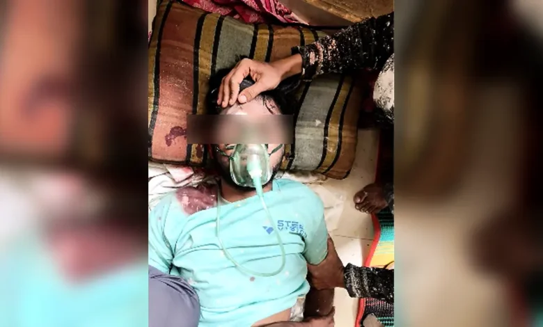 যশোর পাসপোর্ট অফিসে রঙ করতে গিয়ে ছাদ থেকে পড়ে শ্রমিক গুরুতর আহত