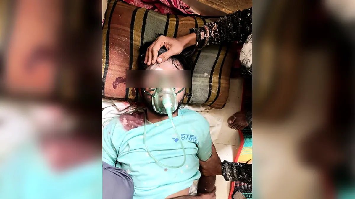 যশোর পাসপোর্ট অফিসে রঙ করতে গিয়ে ছাদ থেকে পড়ে শ্রমিক গুরুতর আহত