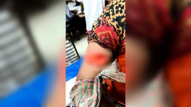 যশোরের ভেকুটিয়ায় পারিবারিক কলহে স্ত্রীকে দা দিয়ে কুপিয়ে আহত করল স্বামী