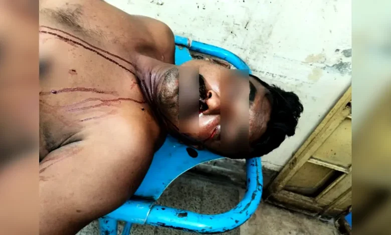 পুটখালী বাজারে পূর্ব শত্রুতার জেরে ব্যক্তিকে কুপিয়ে জখম