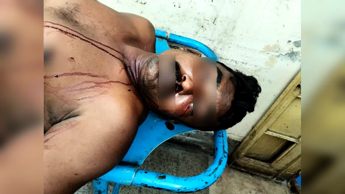 পুটখালী বাজারে পূর্ব শত্রুতার জেরে ব্যক্তিকে কুপিয়ে জখম