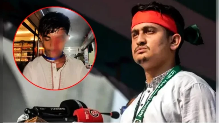 আলিফের চোখের দৃষ্টি টোটালি শেষ: চিকিৎসকের বরাতে সার্জিস