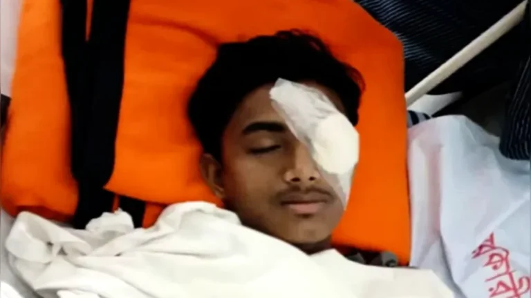 বাবা অসুস্থ, মা প্রতিবন্ধী: হবিগঞ্জে হামলায় চোখ হারালেন আলিফ