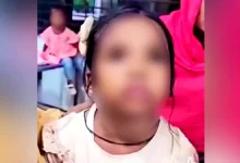 বিড়ালের আঁচড়ের পর শিশুর ‘মিউ মিউ’ শব্দ, কারণ জানালেন চিকিৎসক