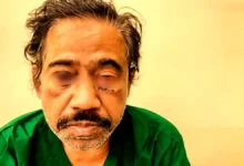 চেয়েছিল ১৫ হাজার ডলার চাঁদা, না দেওয়ায় ঢামেক চিকিৎসকের ওপর হামলা